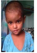 Two-year old Sarawasti; New kid at the Orphanage