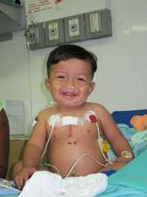 Little Argel day after surgery