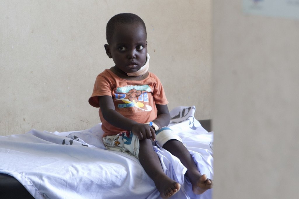 Cure 250 Children with Burkitt Lymphoma in Africa