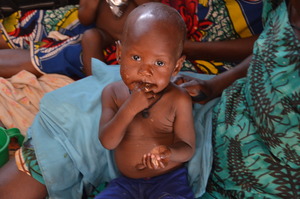 Little boy eating Plumpy'Nut in a Niger clinic