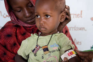 A child in the Sahel w/ Severe Acute Malnutrition