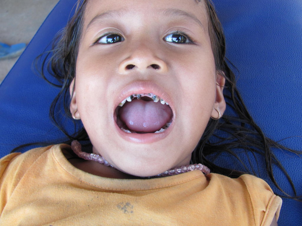 Dental care for 20,000 cambodian children
