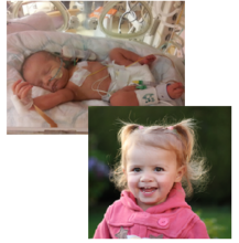 Martha in hospital and now, aged 3.