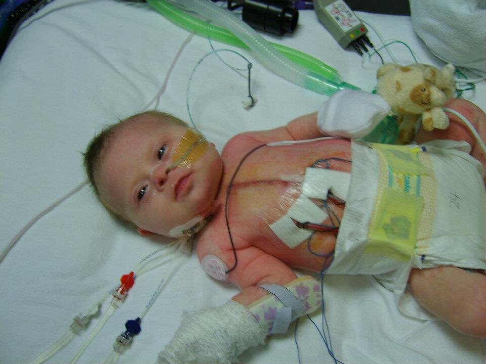 Help babies with serious heart conditions