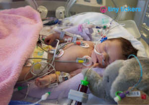 Help babies with serious heart conditions