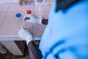 Testing the blood for malaria parasties