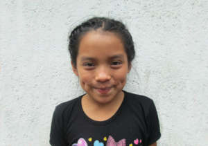 Concepcion smiling after her surgery