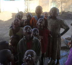 Children showing off their improved teeth